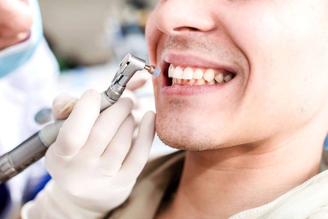 Trattamenti di igiene dentale studio dentistico Edenta Cadelbosco di Sopra Reggio Emilia preventivo Igiene dentale