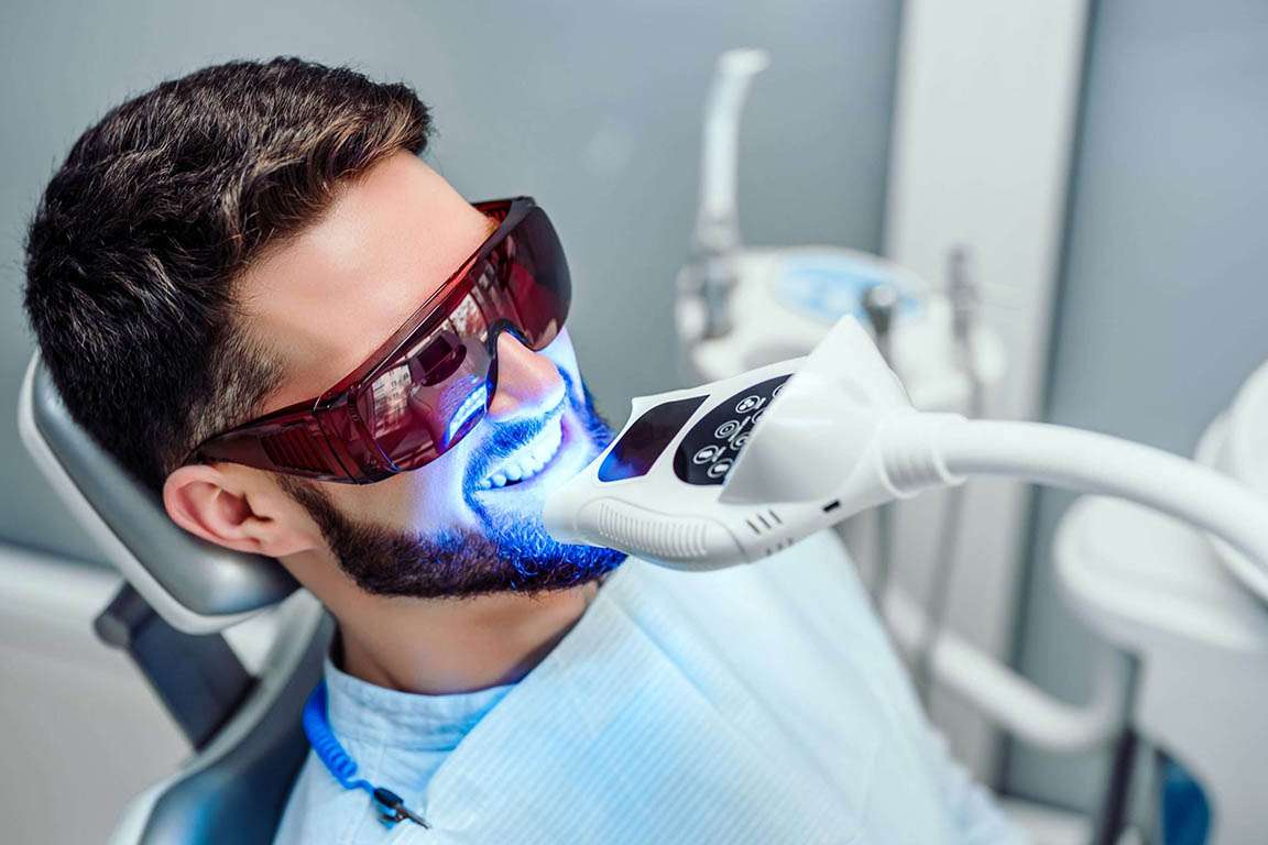 Trattamenti di sbiancamento laser studio dentistico Edenta Cadelbosco di Sopra Reggio Emilia preventivo Sbiancamento laser